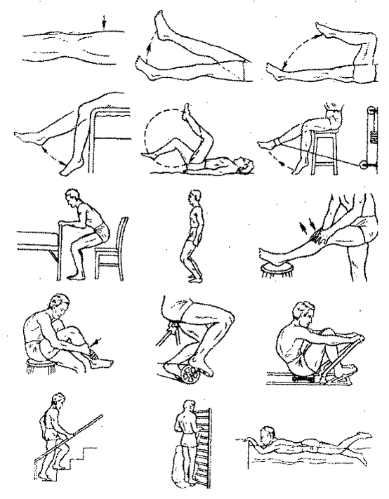 Therapeutic exercises for the arthrosis of the knee joint