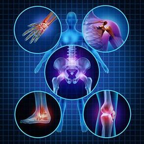 How to facilitate the mobility of the joints with arthritis and arthrosis in treatment