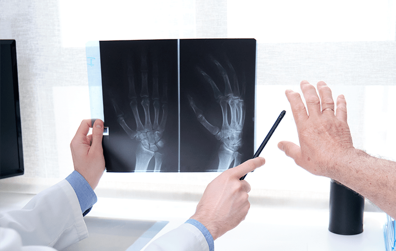 diagnosis of joint arthrosis