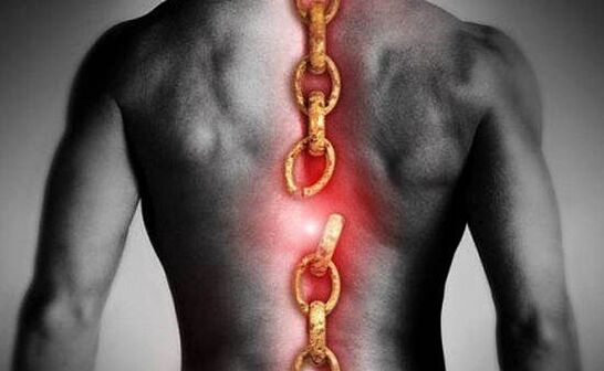 Osteochondrosis of the thoracic region