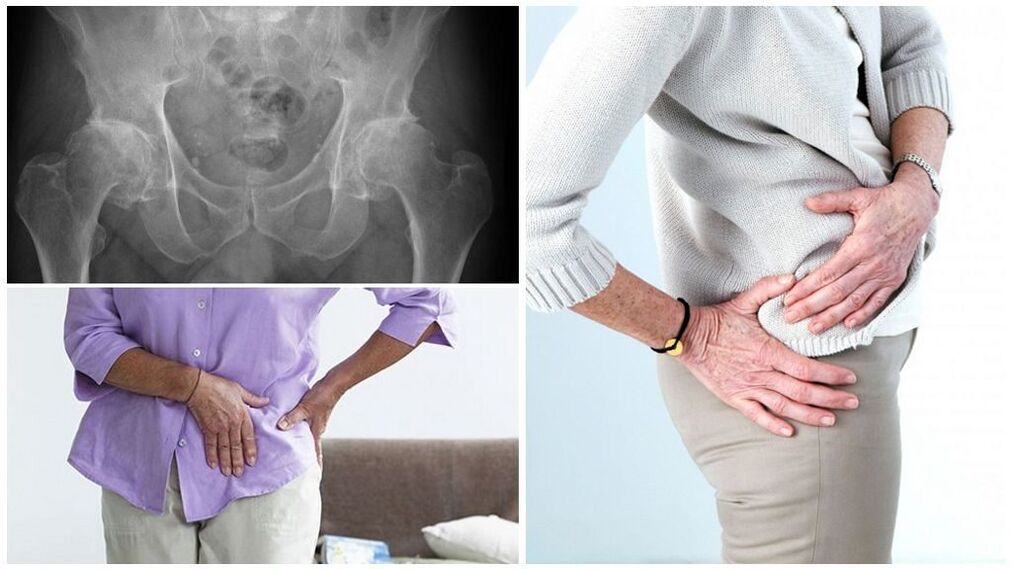 There are many reasons why the pathology develops